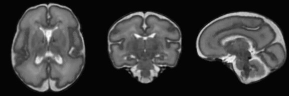 Generative Adversarial Registration for Improved Conditional Deformable Templates