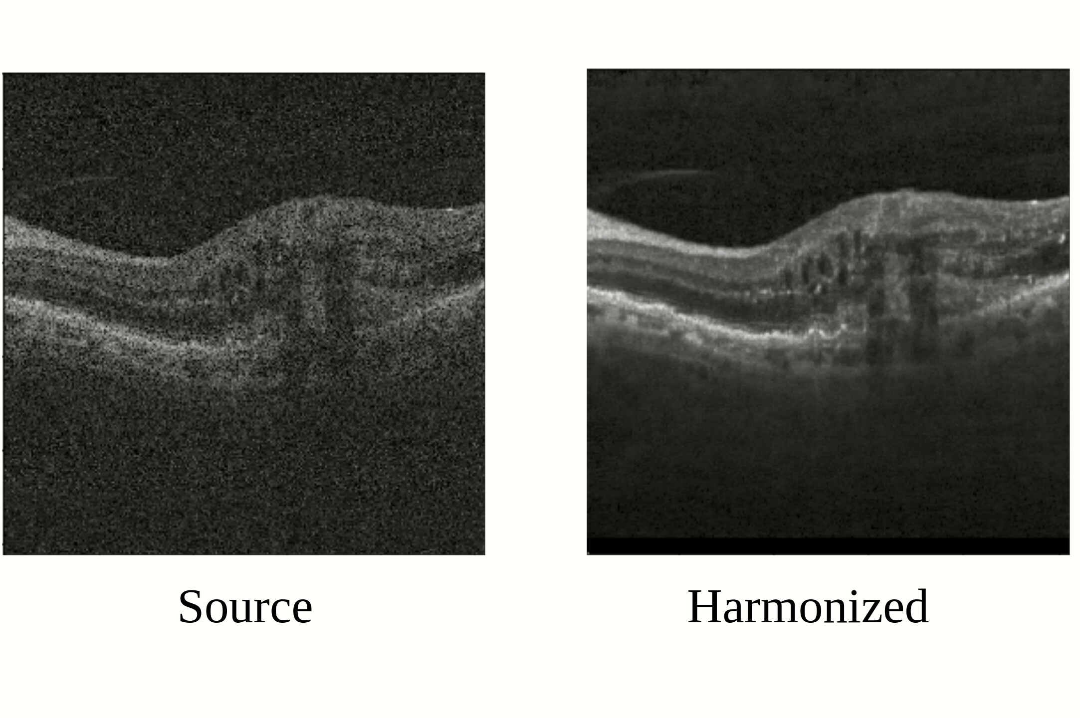 Segmentation-Renormalized Deep Feature Modulation for Unpaired Image Harmonization